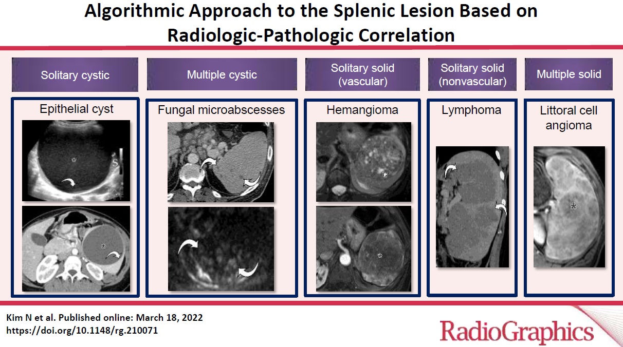 Approach to the Splenic Lesion Based on Radiologic-Pathologic Correlation